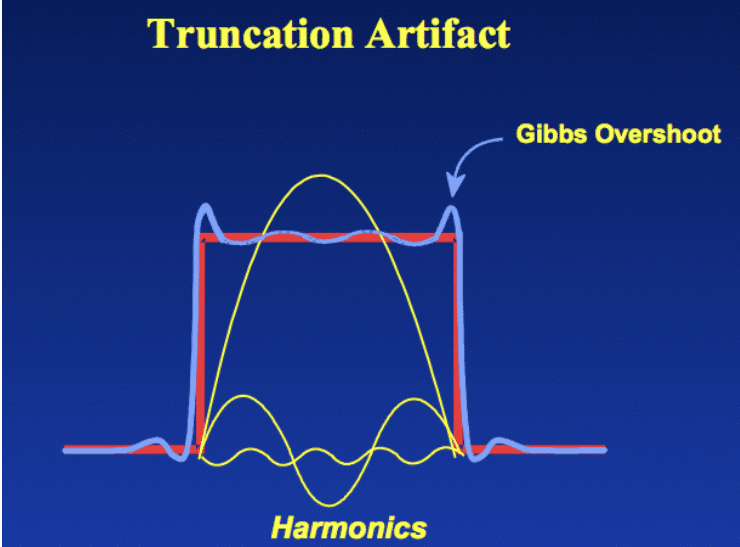 Truncation Artifact e1683748778397 - Unison